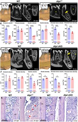 Perspective on Dentoalveolar Manifestations Resulting From PHOSPHO1 Loss-of-Function: A Form of Pseudohypophosphatasia?